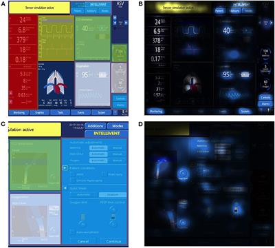 Differing Visual Behavior Between Inexperienced and Experienced Critical Care Nurses While Using a Closed-Loop Ventilation System—A Prospective Observational Study